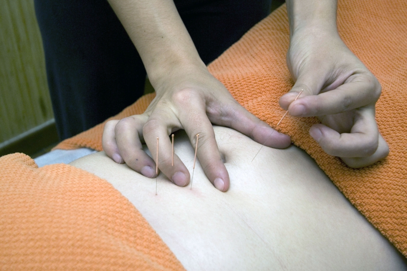 osteopathe-SIX FOURS LES PLAGES-min_acupuncture-4175625